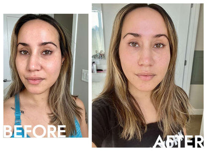 Face Lift Roller