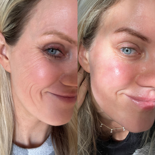 Face Lift Roller